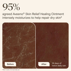 Aveeno Skin Relief Healing Ointment for Dry and Cracked Skin - Glycerin - Non-Greasy - 7.2 oz