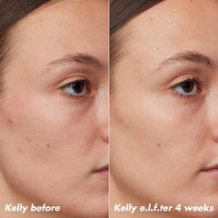 e.l.f. SKIN PLZ Clarify Facial Oil - 2% Salicylic Acid Acne Treatment + Aloe Extract - 1 fl oz